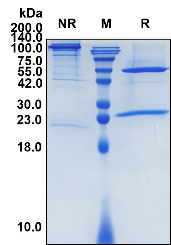 Atezolizumab (Biosimilar Reference Antibody) (PDL1)