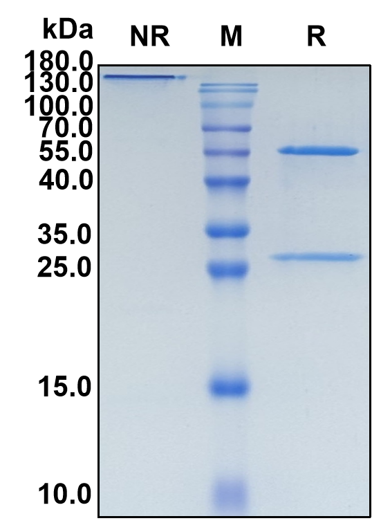 Cosfroviximab (Biosimilar Reference Antibody) (Zaire Ebolavirus Glycoprotein)