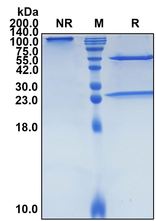 Denosumab (Biosimilar Reference Antibody) (TNFSF11)