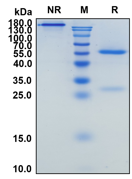 Obinutuzumab (Biosimilar Reference Antibody) (MS4A1)