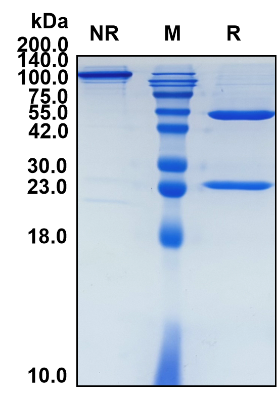 Tocilizumab (Biosimilar Reference Antibody) (IL6R)