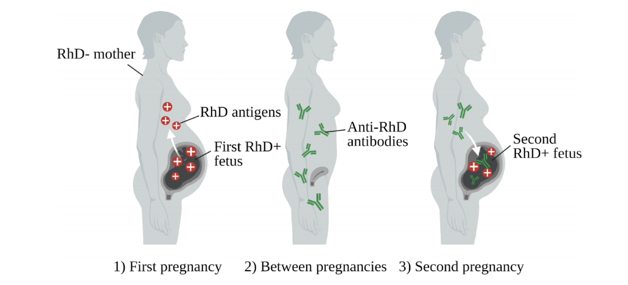 Blood Group Antigen RHD Blood Group Antigen RHD