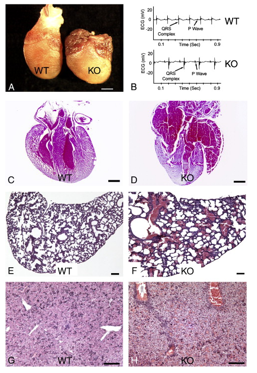 Ephrin type-A receptor 3
