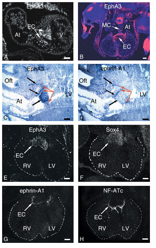 Ephrin type-A receptor 3