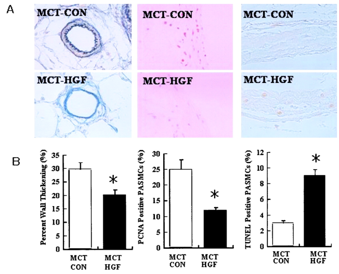 Hepatocyte growth factor HGF