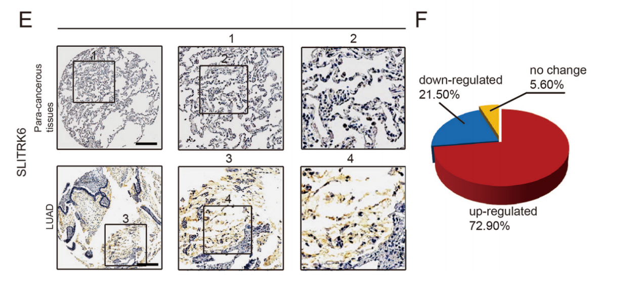 Neurite Outgrowth Regulating Factor SLITRK6 Neurite Outgrowth Regulating Factor SLITRK6