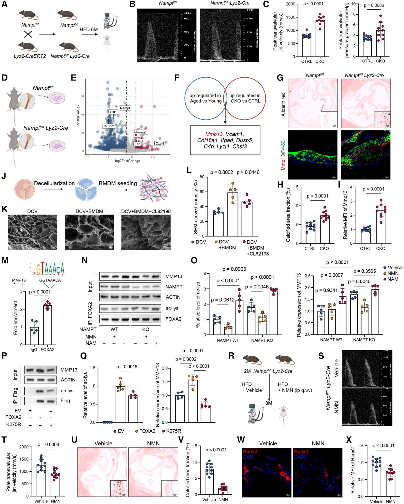 Senescence-associated metabolic alterations aggravate calcific aortic valve disease
