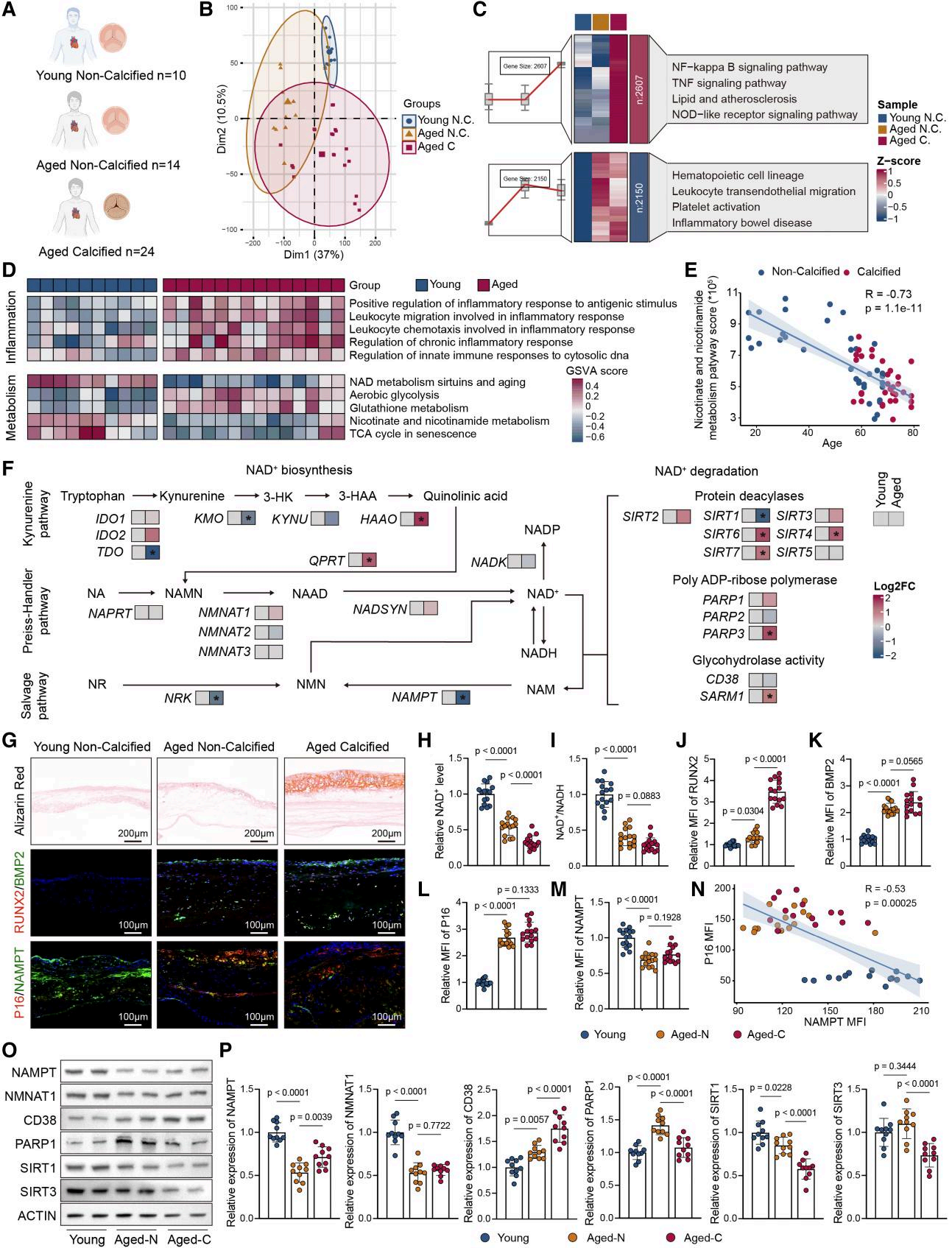 Senescence-associated metabolic alterations aggravate calcific aortic valve disease