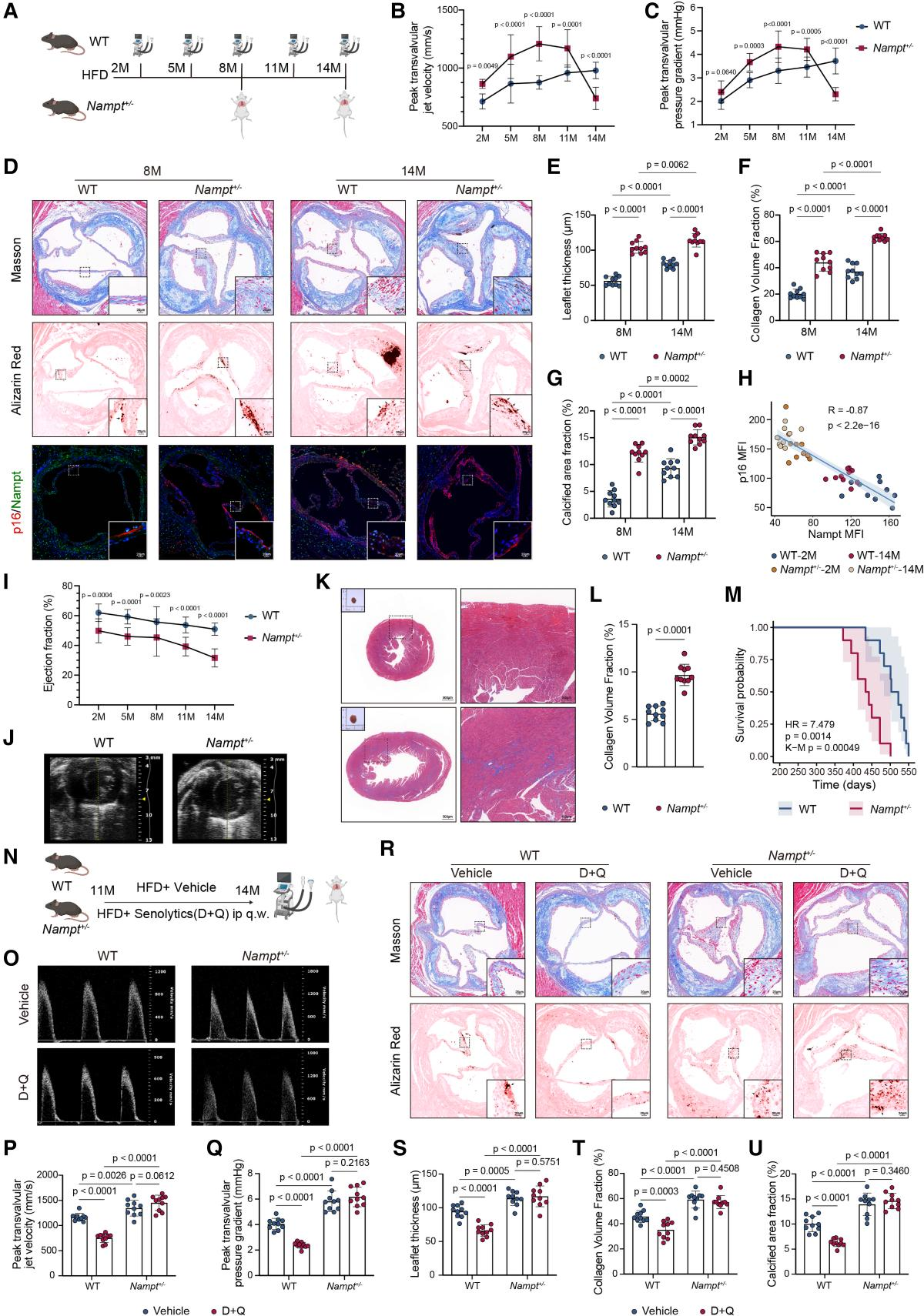 Senescence-associated metabolic alterations aggravate calcific aortic valve disease