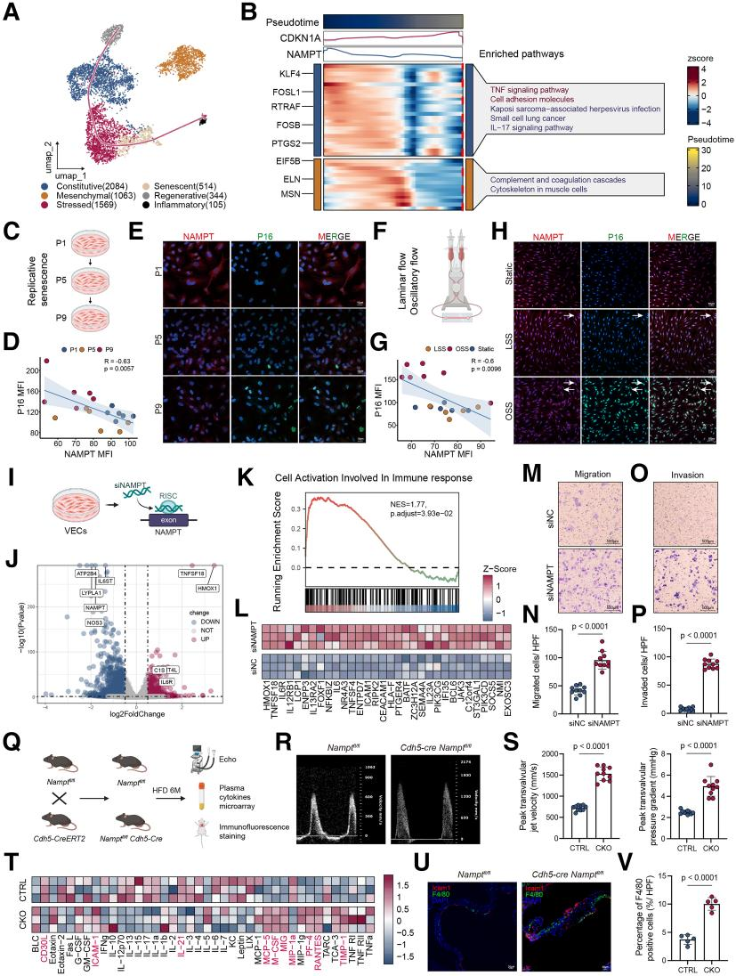 Senescence-associated metabolic alterations aggravate calcific aortic valve disease