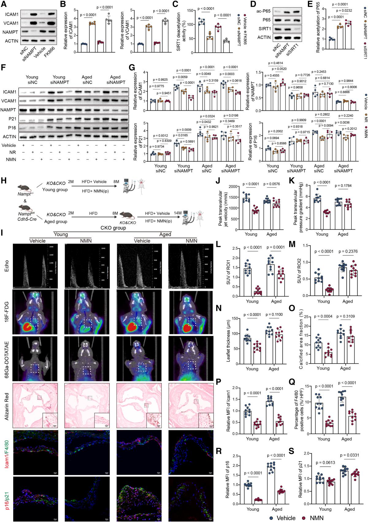 Senescence-associated metabolic alterations aggravate calcific aortic valve disease