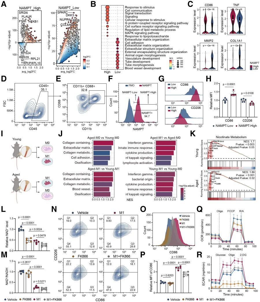 Senescence-associated metabolic alterations aggravate calcific aortic valve disease
