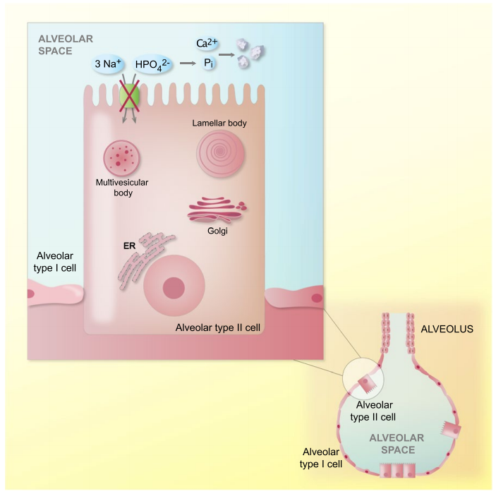 Sodium dependent phosphate transporter SLC34A2