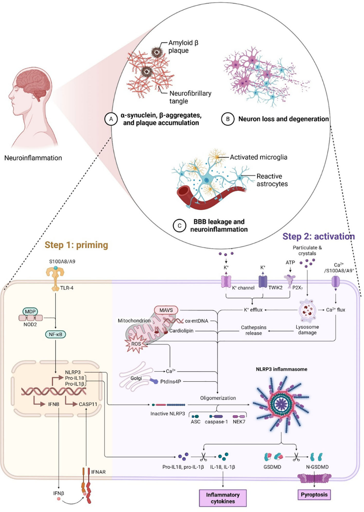 Tumor microenvironment proinflammatory factors S100A8-S100A9