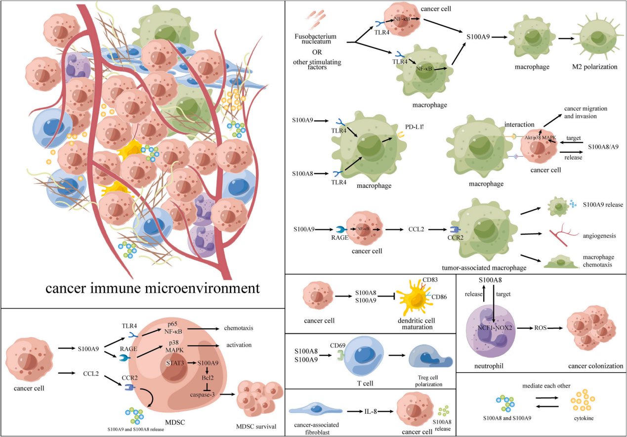 Tumor microenvironment proinflammatory factors S100A8-S100A9
