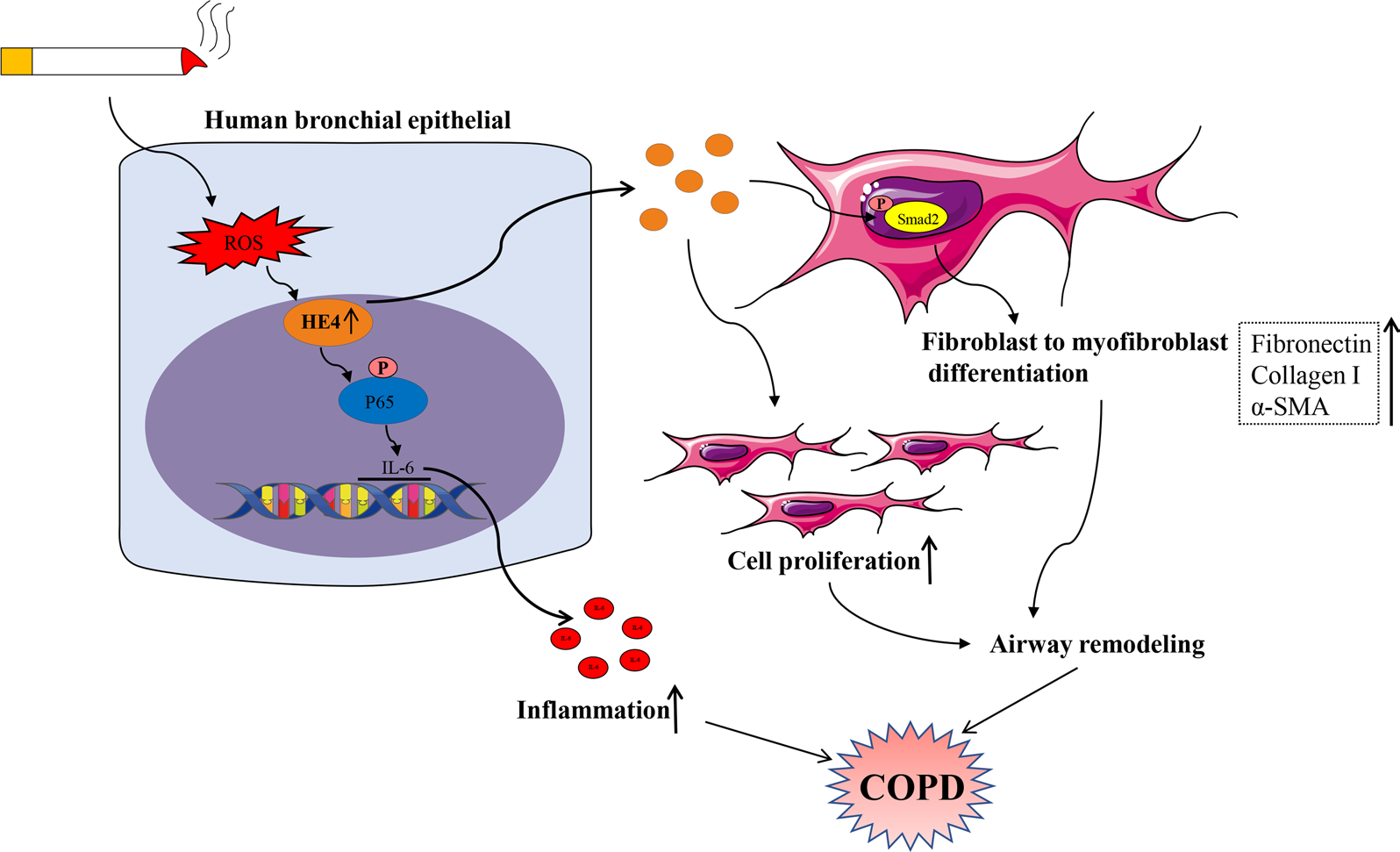 A new marker for ovarian cancer detection HE4