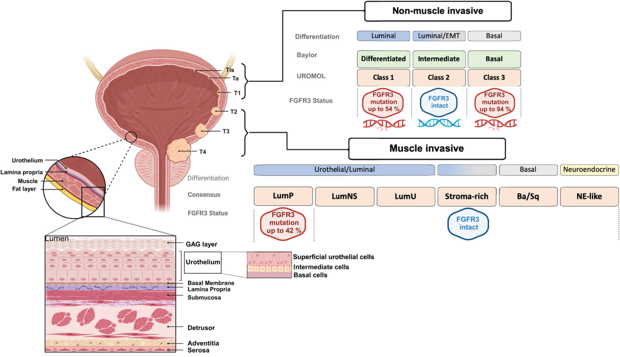 Bladder Cancer Treatment Target FGFR3