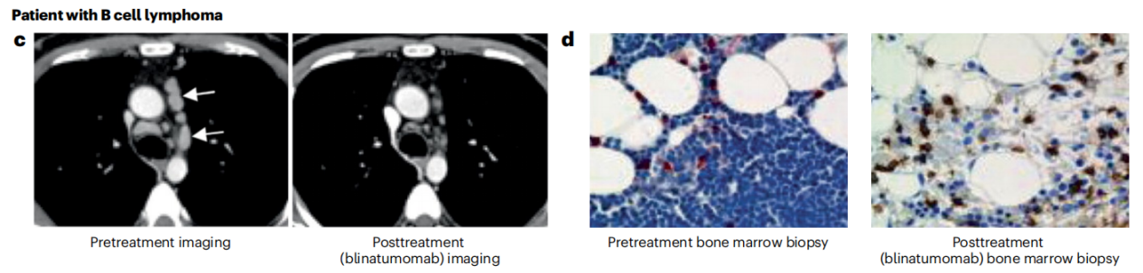 Cancer therapy with antibodies