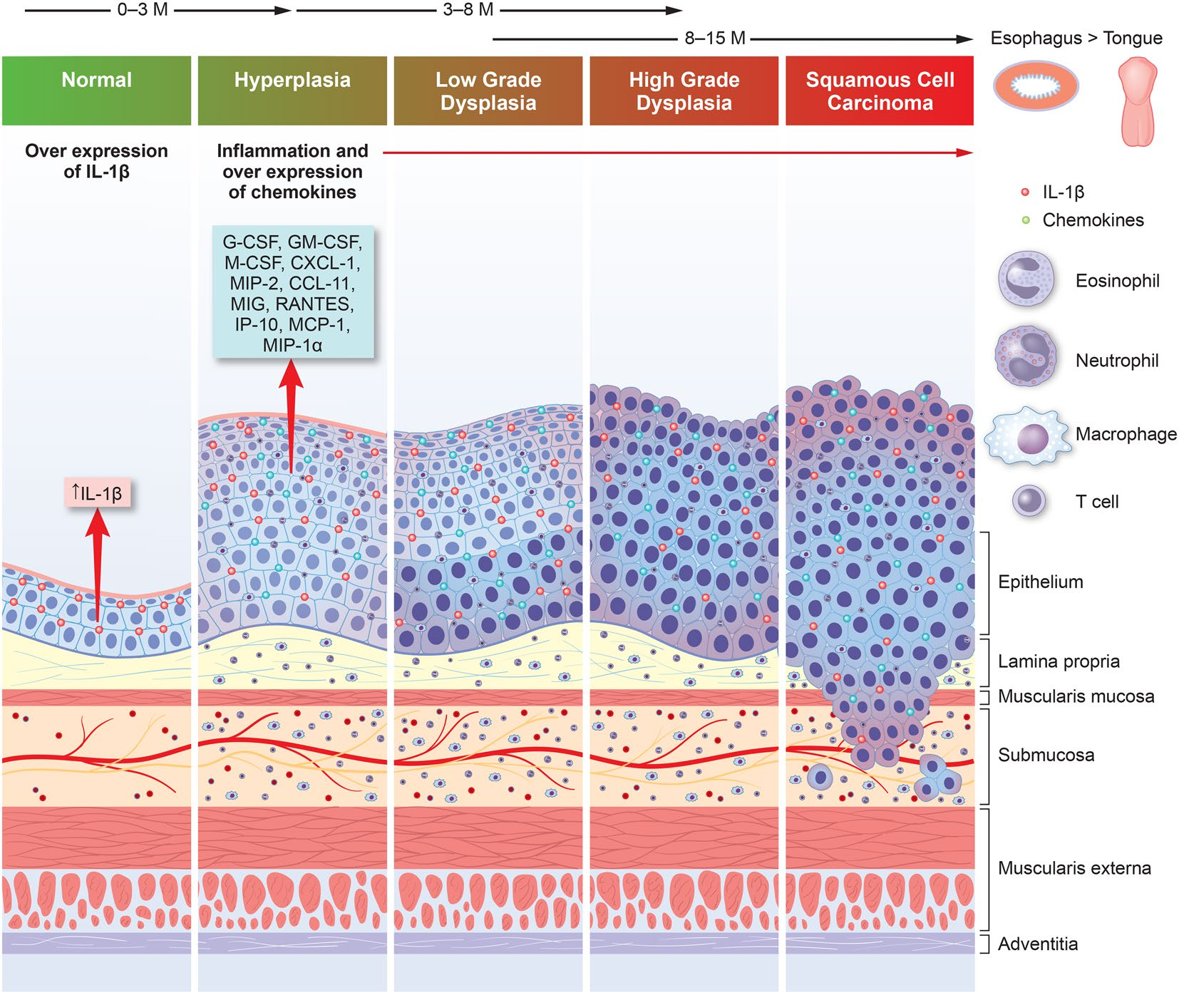 Inflammatory cytokine IL1β