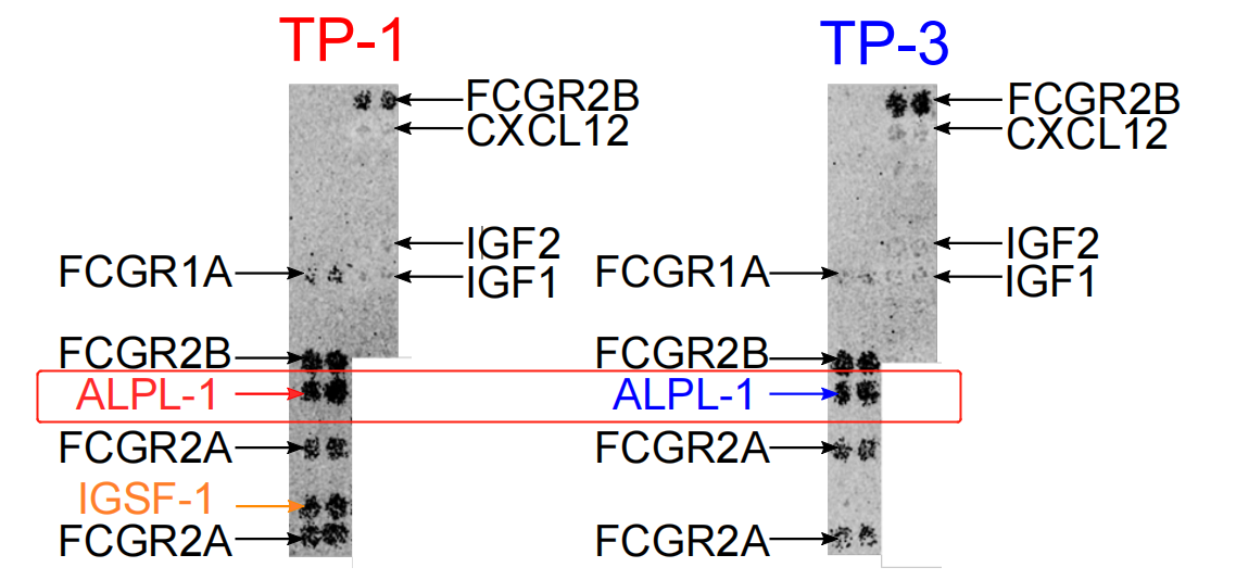 Literature share antibody sequences defined a new target for osteosarcoma CAR-T therapy