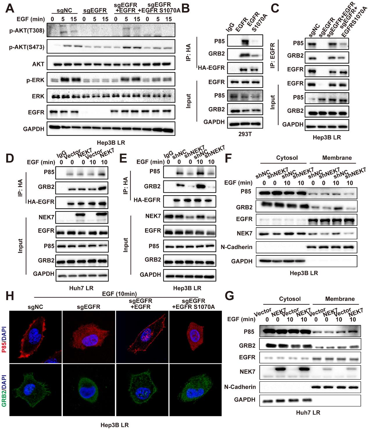 NEK7 phosphorylation of EGFR drives the mechanism of drug resistance in hepatocellular carcinoma