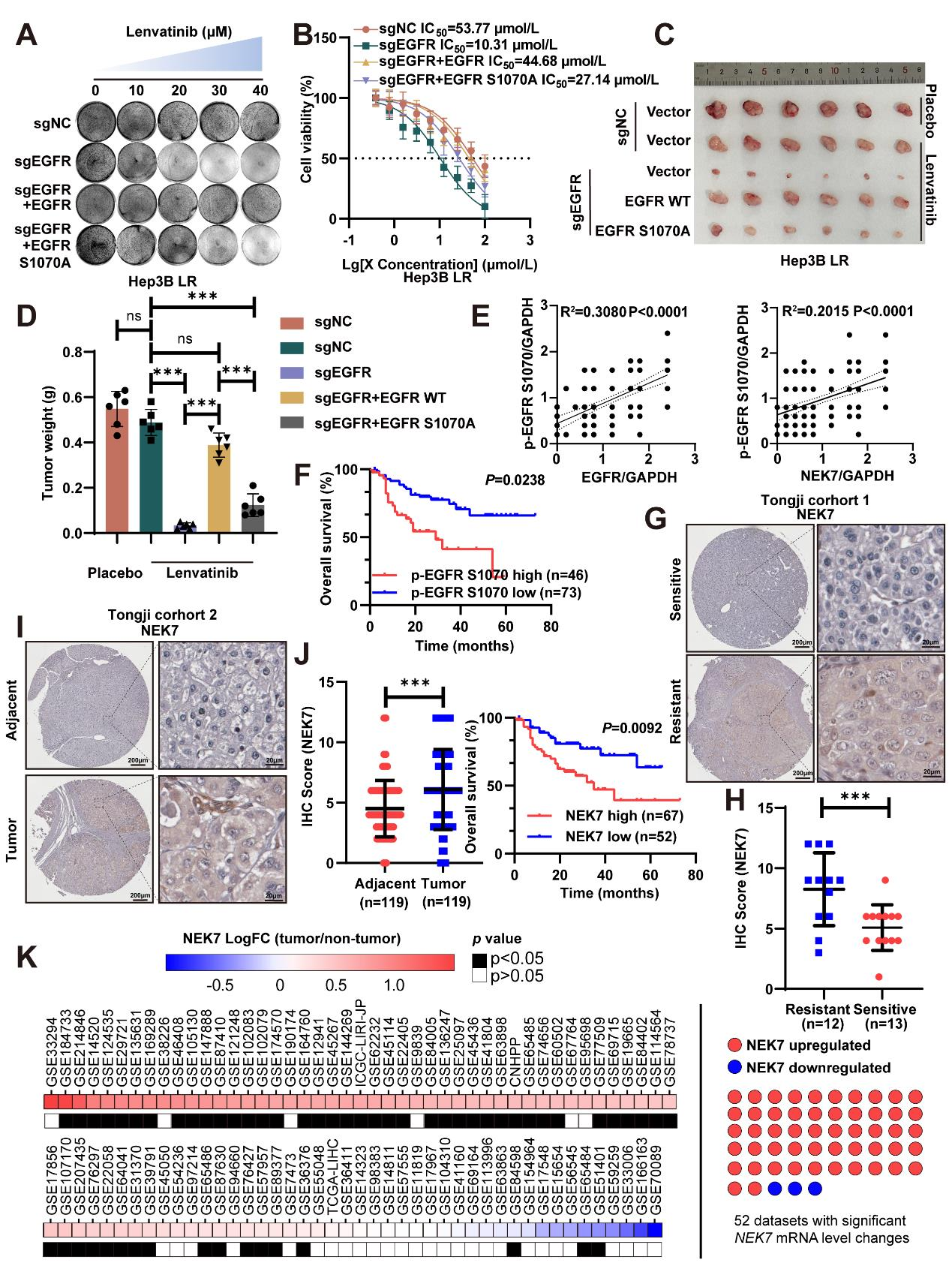 NEK7 phosphorylation of EGFR drives the mechanism of drug resistance in hepatocellular carcinoma