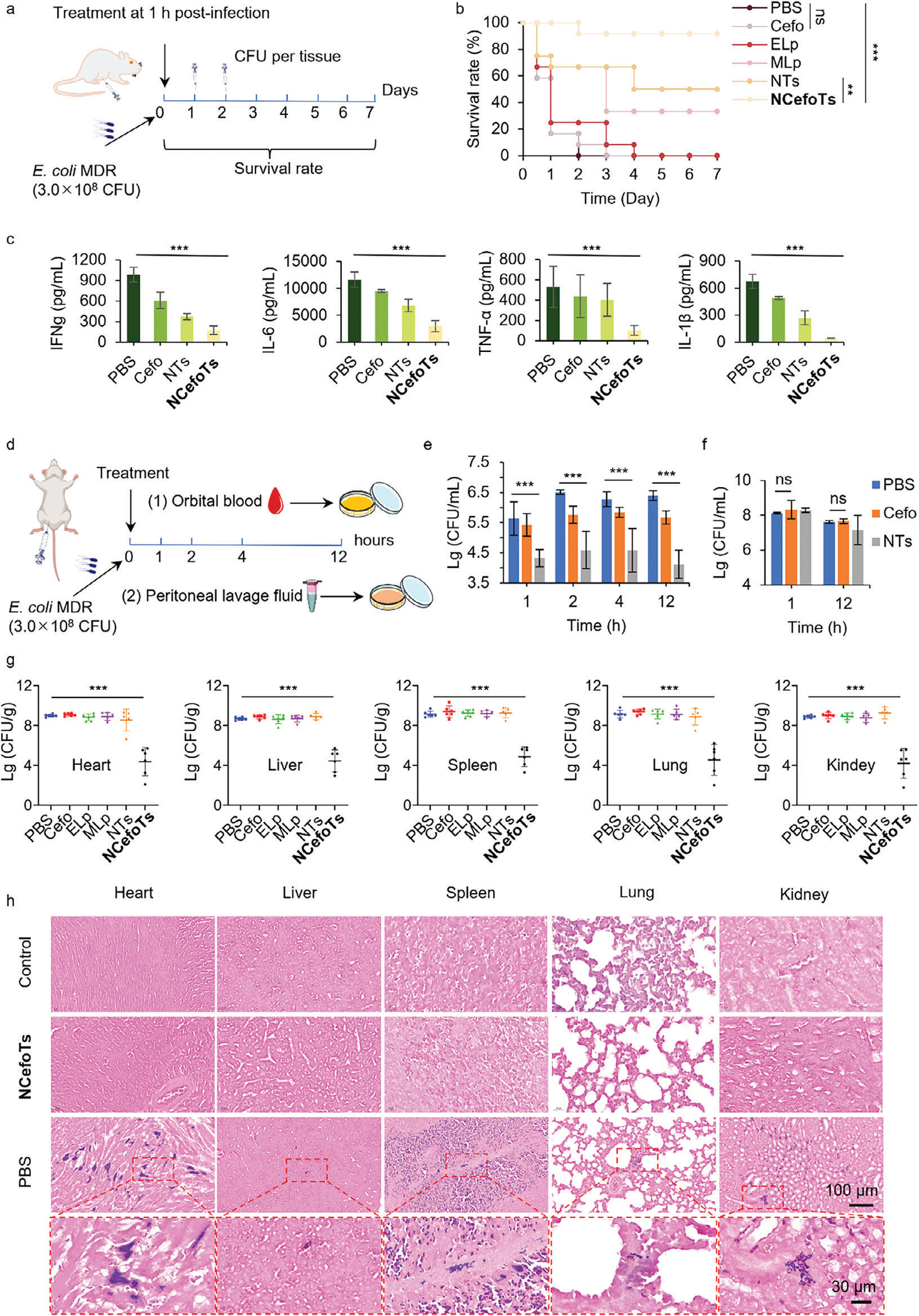 Phase-Separated Nano-Antibiotics Enhanced Survival in Multidrug-Resistant Escherichia coli Sepsis by Precise Periplasmic EcDsbA Targeting