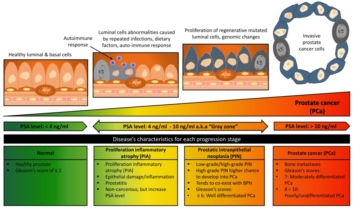 Prostate cancer biomarker PSA