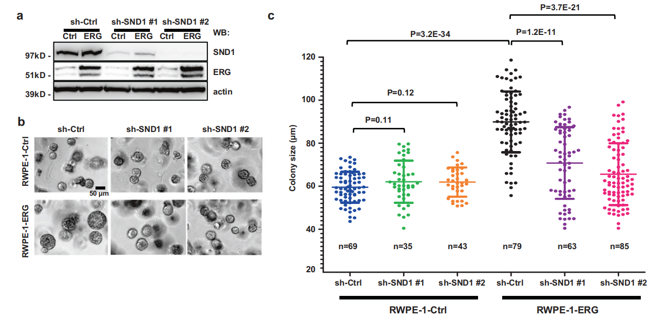 SND1: potential prostate cancer target