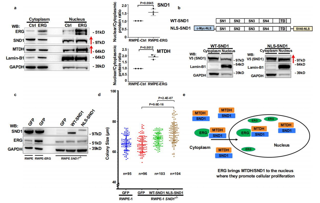 SND1: potential prostate cancer target