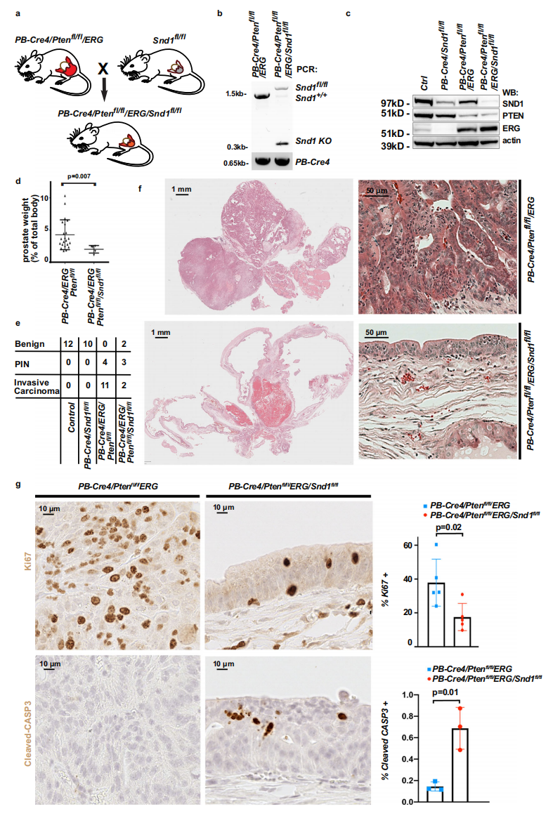 SND1: potential prostate cancer target