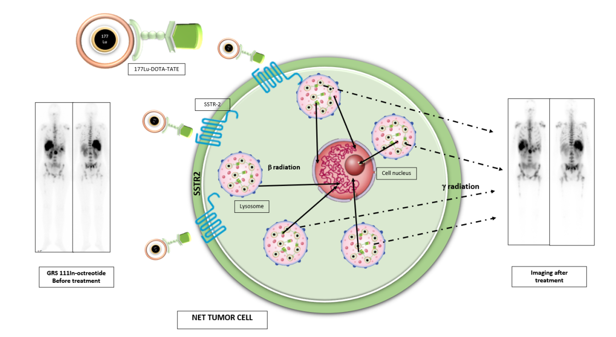 SSTR2 is a therapeutic target for neuroendocrine tumors