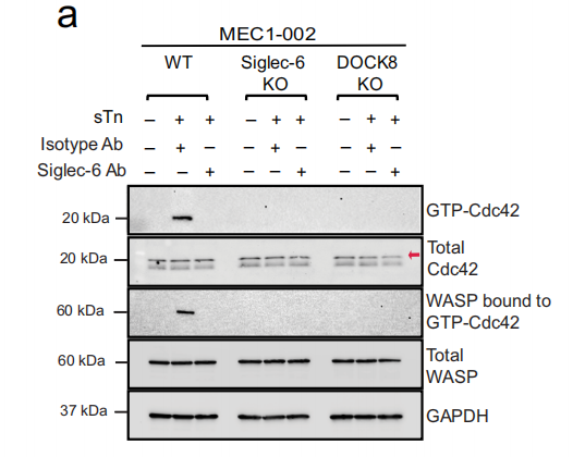 Siglec-6 as a therapeutic target for cell migration and adhesion in chronic lymphocytic leukemia