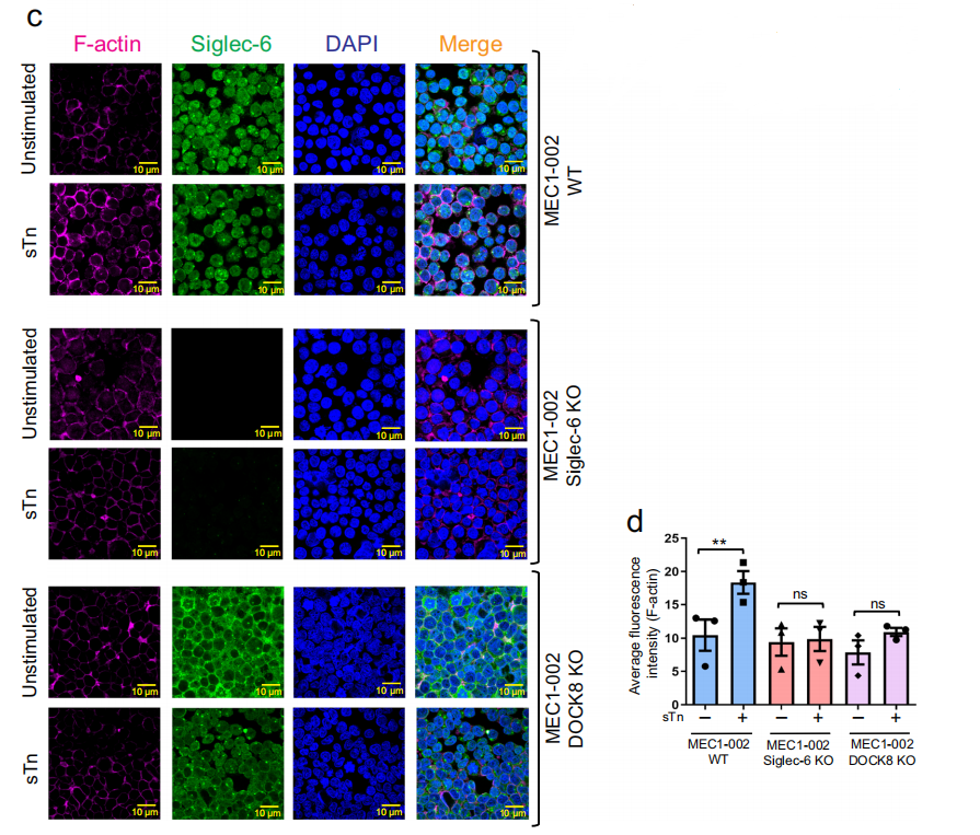 Siglec-6 as a therapeutic target for cell migration and adhesion in chronic lymphocytic leukemia