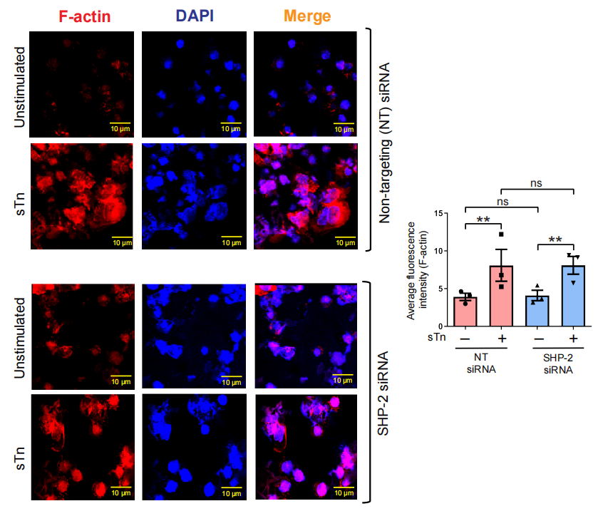 Siglec-6 as a therapeutic target for cell migration and adhesion in chronic lymphocytic leukemia