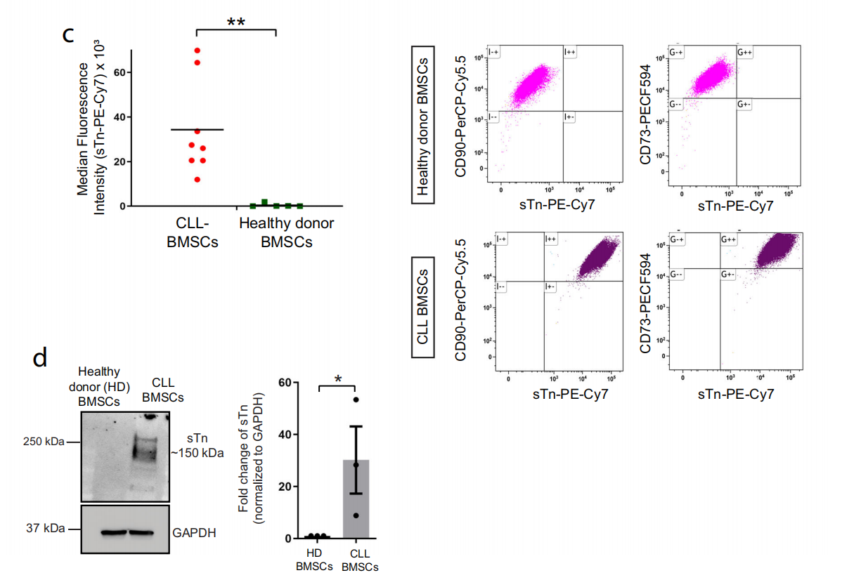 Siglec-6 as a therapeutic target for cell migration and adhesion in chronic lymphocytic leukemia