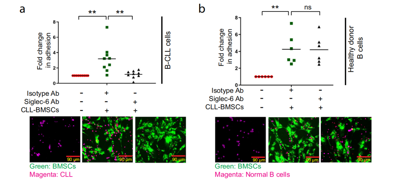 Siglec-6 as a therapeutic target for cell migration and adhesion in chronic lymphocytic leukemia