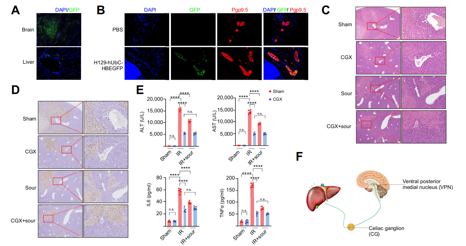 Sour neuronal signalling attenuates macrophage mediated liver injury