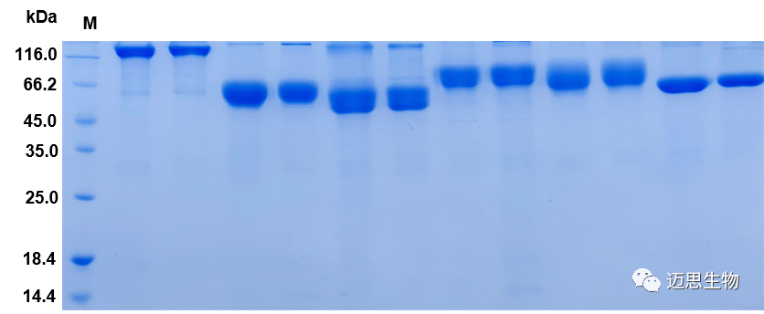 Suitable conditions were selected for eukaryotic protein expression