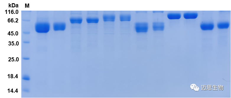 Suitable conditions were selected for eukaryotic protein expression