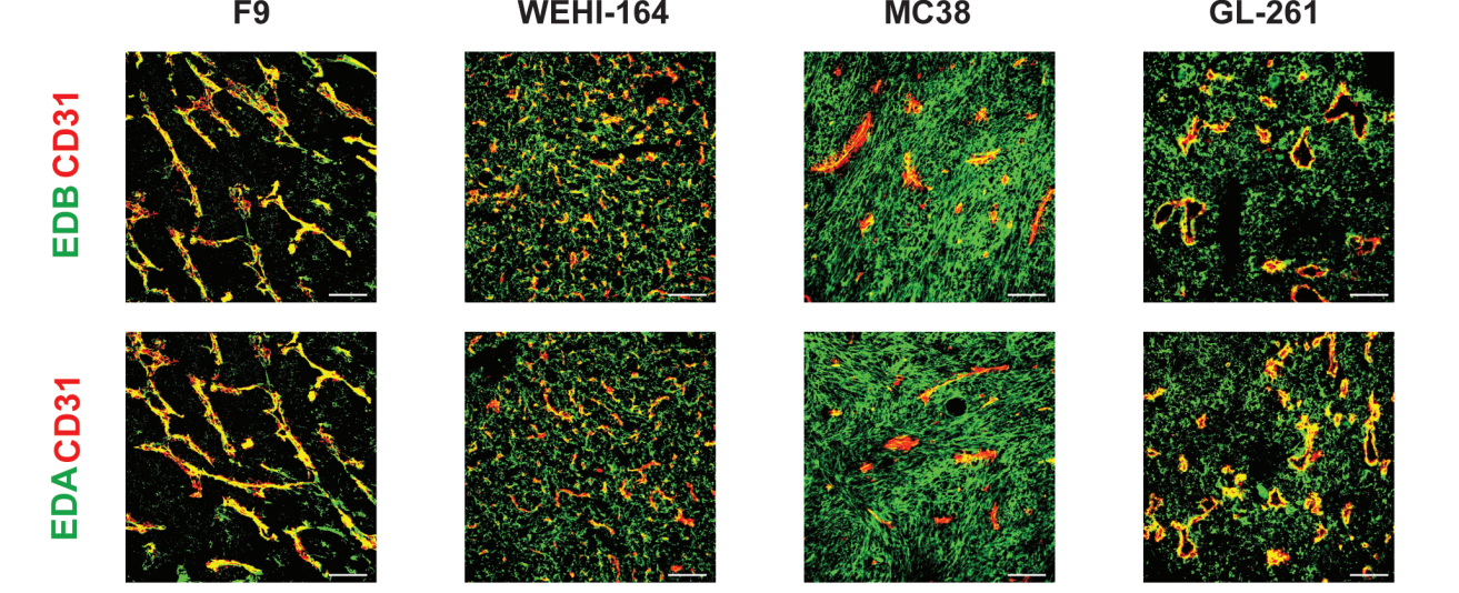 The IL-7 fusion protein F8 (scDb) IL7 up regulates TCF1 and promotes PD-1 blockade