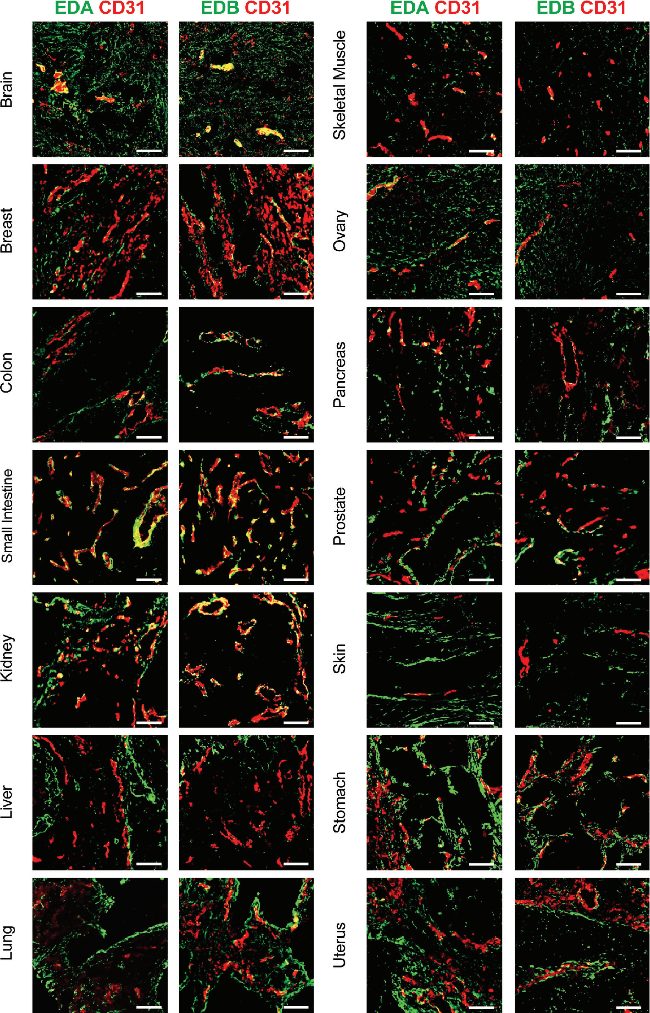 The IL-7 fusion protein F8 (scDb) IL7 up regulates TCF1 and promotes PD-1 blockade