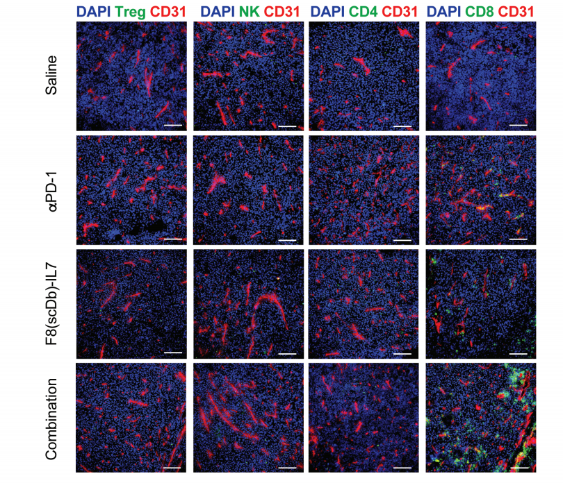 The IL-7 fusion protein F8 (scDb) IL7 up regulates TCF1 and promotes PD-1 blockade
