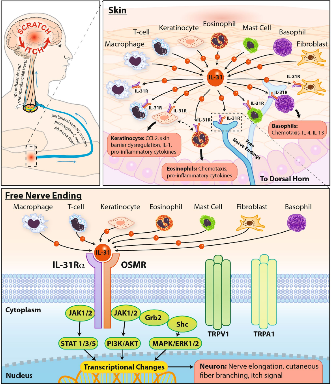 The inflammatory itch cytokine IL-31