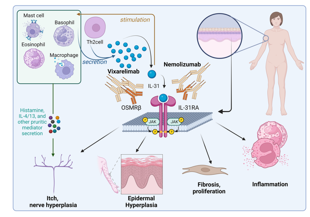The inflammatory itch cytokine IL-31