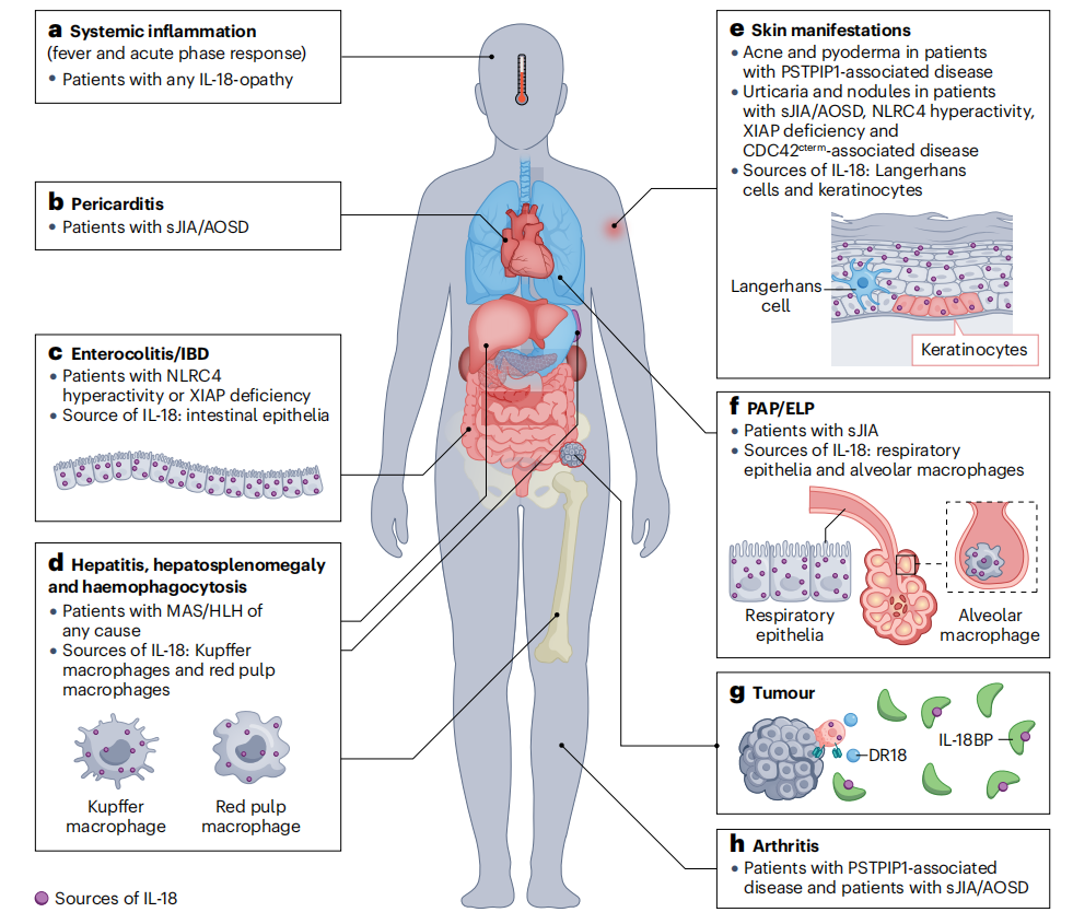 The proinflammatory cytokine IL18