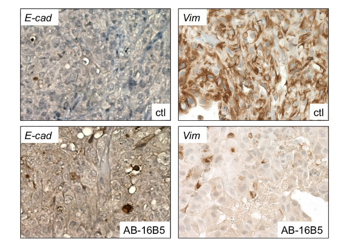 Tumor microenvironment homeostasis regulator CLU