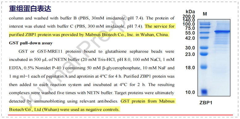 ZBP1 can antagonize the DNA end excision mediated by MRE11
