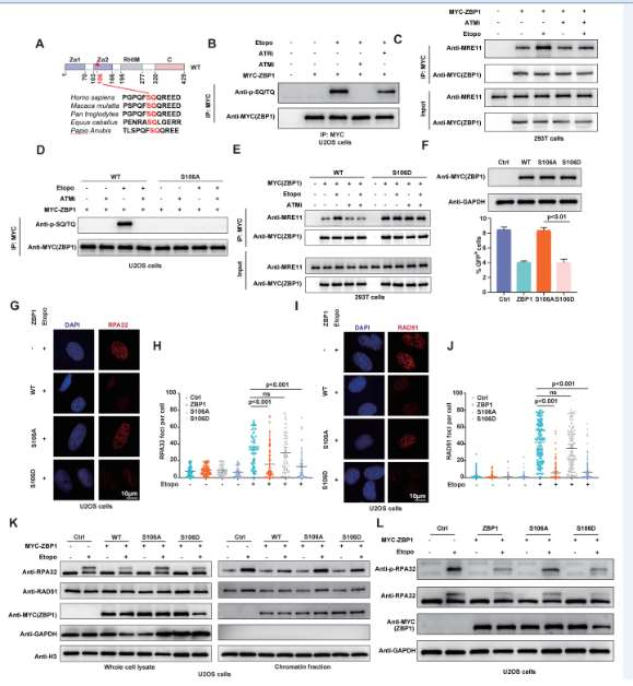 ZBP1 can antagonize the DNA end excision mediated by MRE11