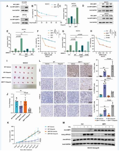 ZBP1 can antagonize the DNA end excision mediated by MRE11